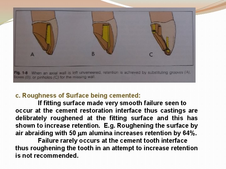 c. Roughness of Surface being cemented: If fitting surface made very smooth failure seen