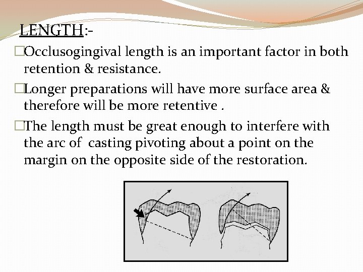 LENGTH: �Occlusogingival length is an important factor in both retention & resistance. �Longer preparations