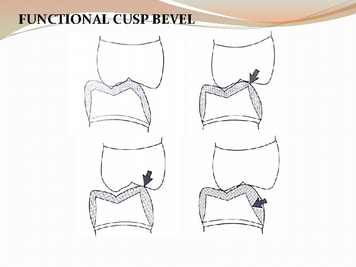 FUNCTIONAL CUSP BEVEL 