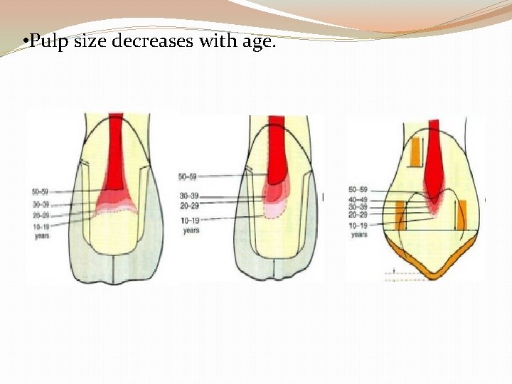  • Pulp size decreases with age. 