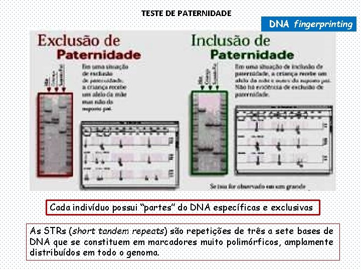 TESTE DE PATERNIDADE DNA fingerprinting Cada indivíduo possui “partes” do DNA específicas e exclusivas