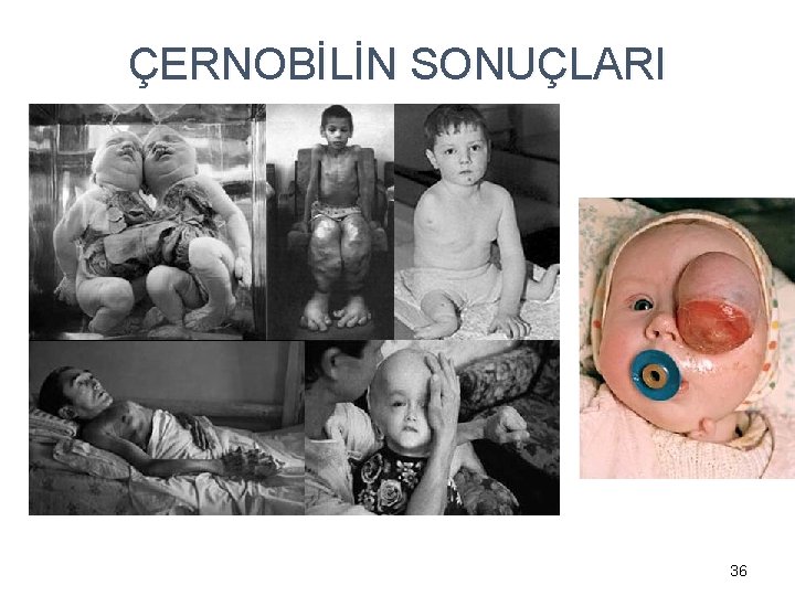 ÇERNOBİLİN SONUÇLARI 36 