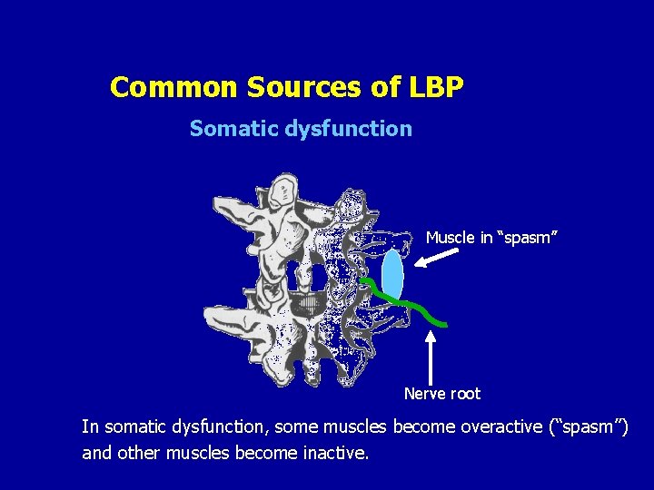 Common Sources of LBP Somatic dysfunction Muscle in “spasm” Nerve root In somatic dysfunction,