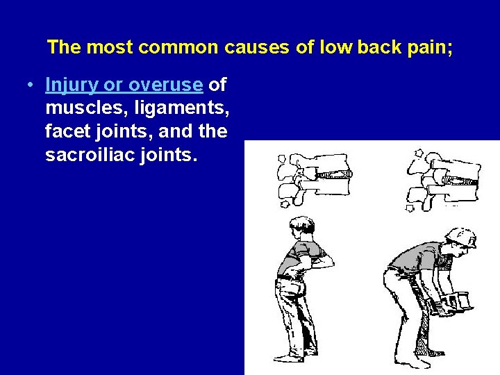 The most common causes of low back pain; • Injury or overuse of muscles,