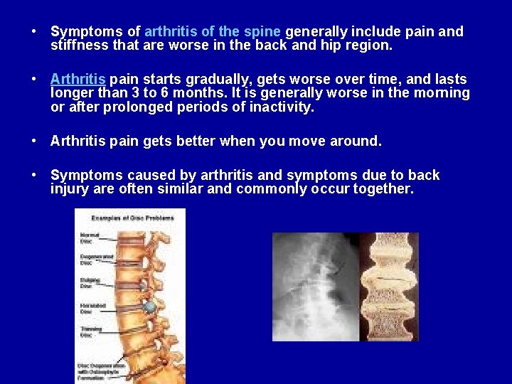  • Symptoms of arthritis of the spine generally include pain and stiffness that