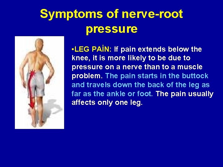 Symptoms of nerve-root pressure • LEG PAİN: If pain extends below the knee, it