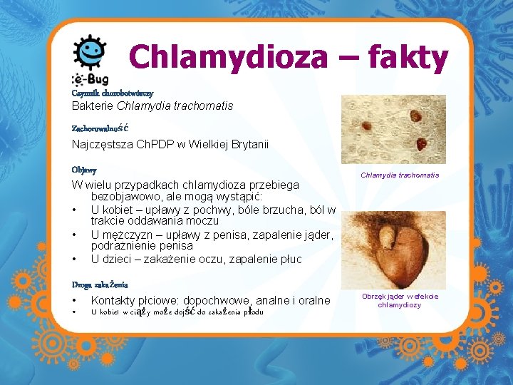 Chlamydioza – fakty Czynnik chorobotwórczy Bakterie Chlamydia trachomatis Zachorowalność Najczęstsza Ch. PDP w Wielkiej