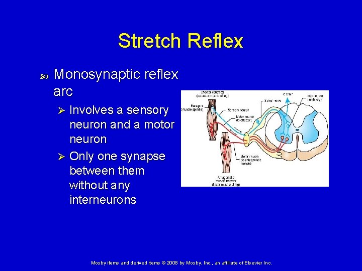 Stretch Reflex Monosynaptic reflex arc Involves a sensory neuron and a motor neuron Ø Stretch Reflex Monosynaptic reflex arc Involves a sensory neuron and a motor neuron Ø