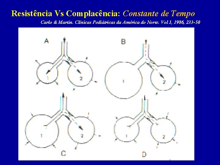 Resistência Vs Complacência: Constante de Tempo Carlo & Martin. Clínicas Pediátricas da América do