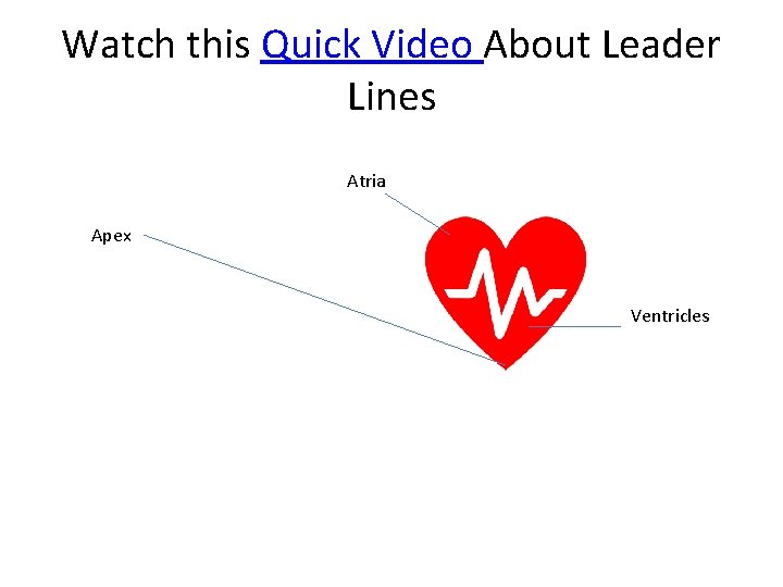 Watch this Quick Video About Leader Lines Atria Apex Ventricles 