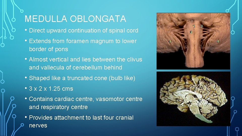 MEDULLA OBLONGATA • Direct upward continuation of spinal cord • Extends from foramen magnum