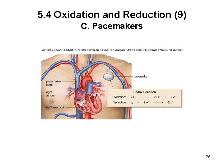 5. 4 Oxidation and Reduction (9) C. Pacemakers 25 