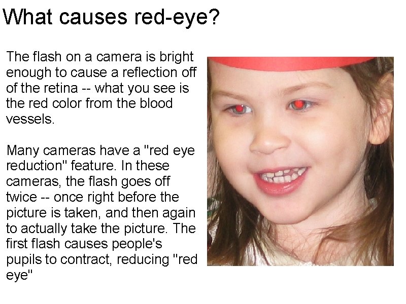 What causes red-eye? The flash on a camera is bright enough to cause a