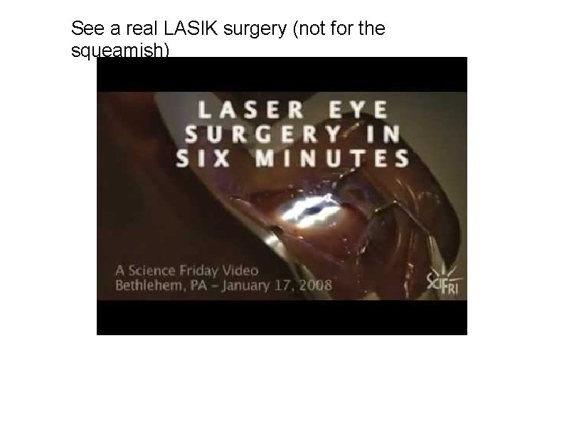 See a real LASIK surgery (not for the squeamish) 