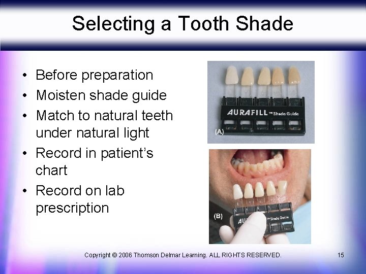 Selecting a Tooth Shade • Before preparation • Moisten shade guide • Match to