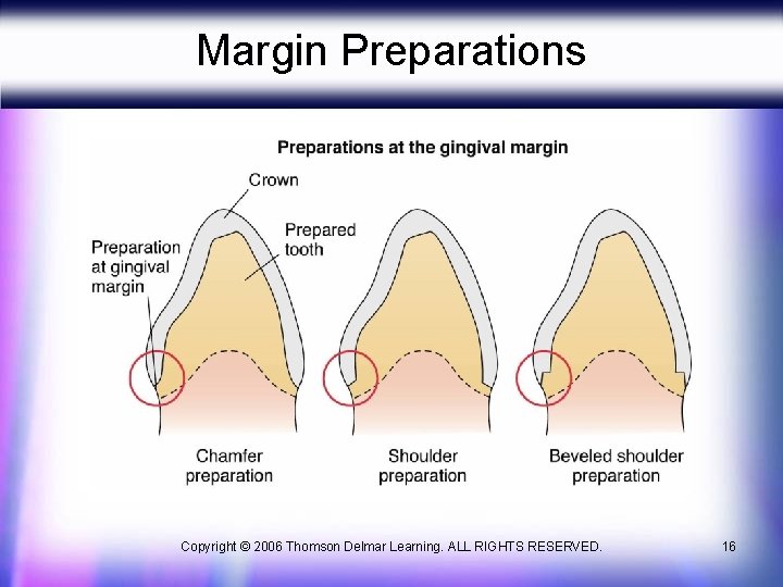 Margin Preparations Copyright © 2006 Thomson Delmar Learning. ALL RIGHTS RESERVED. 16 