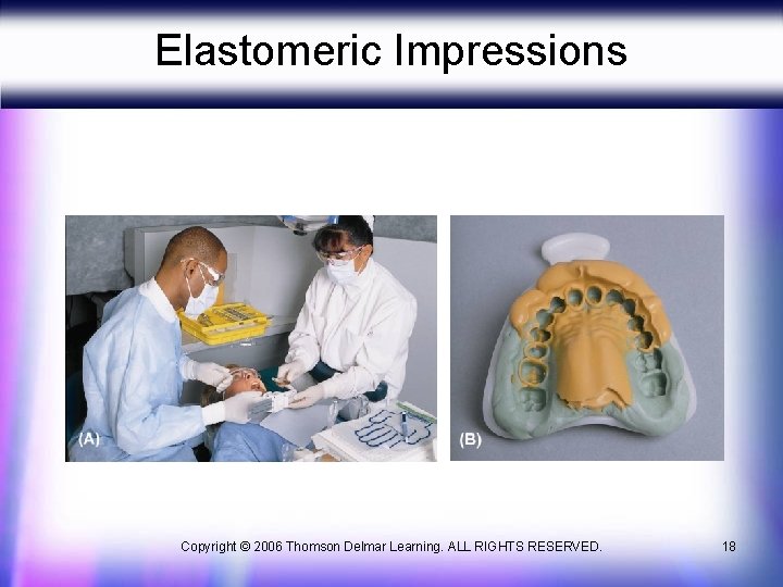 Elastomeric Impressions Copyright © 2006 Thomson Delmar Learning. ALL RIGHTS RESERVED. 18 