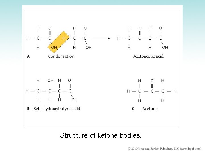 Structure of ketone bodies. 