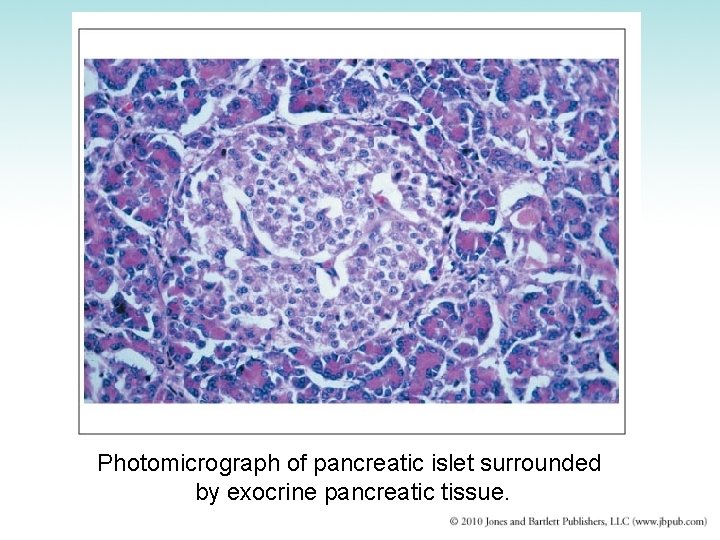 Photomicrograph of pancreatic islet surrounded by exocrine pancreatic tissue. 