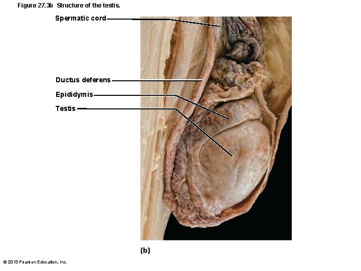 Figure 27. 3 b Structure of the testis. Spermatic cord Ductus deferens Epididymis Testis Figure 27. 3 b Structure of the testis. Spermatic cord Ductus deferens Epididymis Testis