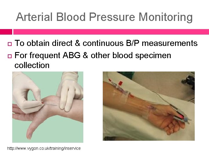 Arterial Blood Pressure Monitoring To obtain direct & continuous B/P measurements For frequent ABG