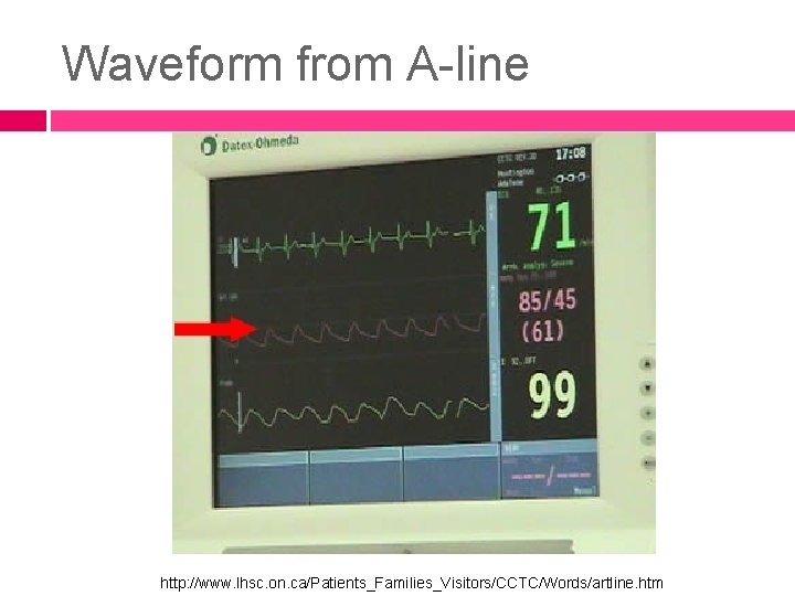 Waveform from A-line http: //www. lhsc. on. ca/Patients_Families_Visitors/CCTC/Words/artline. htm 