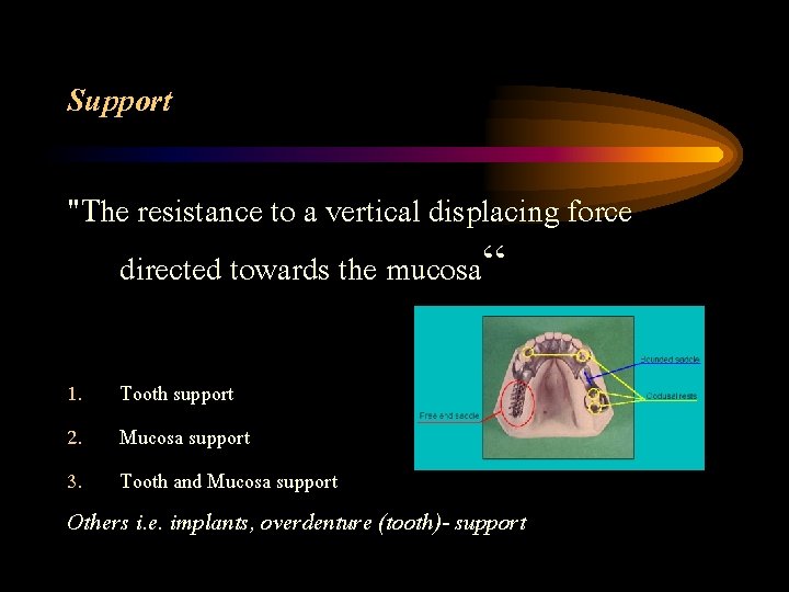 Support "The resistance to a vertical displacing force directed towards the mucosa“ 1. 2.