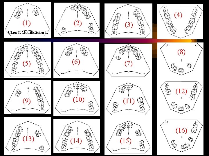 (4) (1) (2) (3) Class I, Modification 1. (8) (5) (6) (7) (12) (9)