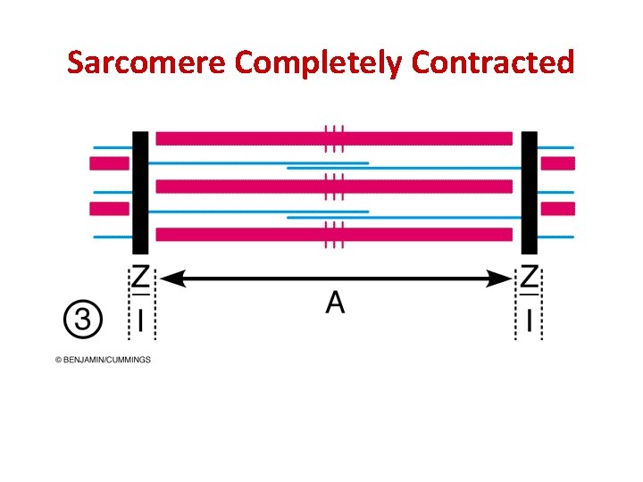 Sarcomere Completely Contracted Sarcomere Completely Contracted