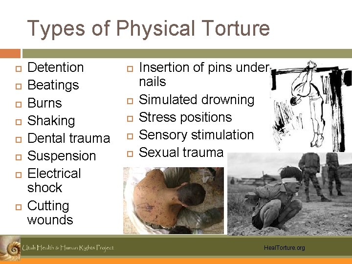 Types of Physical Torture Detention Beatings Burns Shaking Dental trauma Suspension Electrical shock Cutting