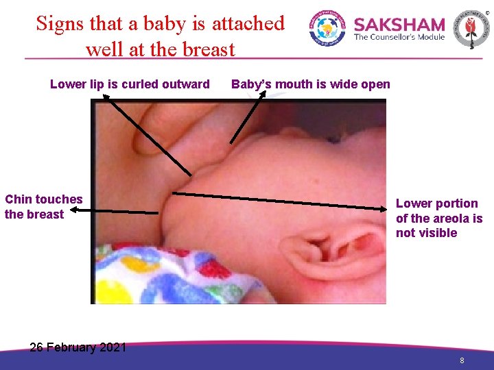Signs that a baby is attached well at the breast Lower lip is curled