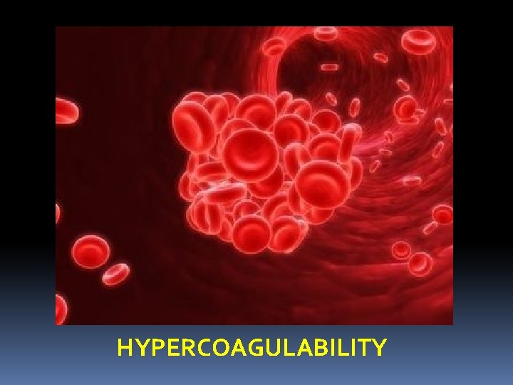 HYPERCOAGULABILITY 