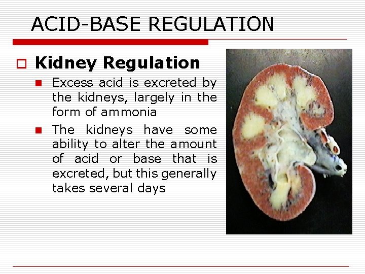 ACID-BASE REGULATION o Kidney Regulation Excess acid is excreted by the kidneys, largely in