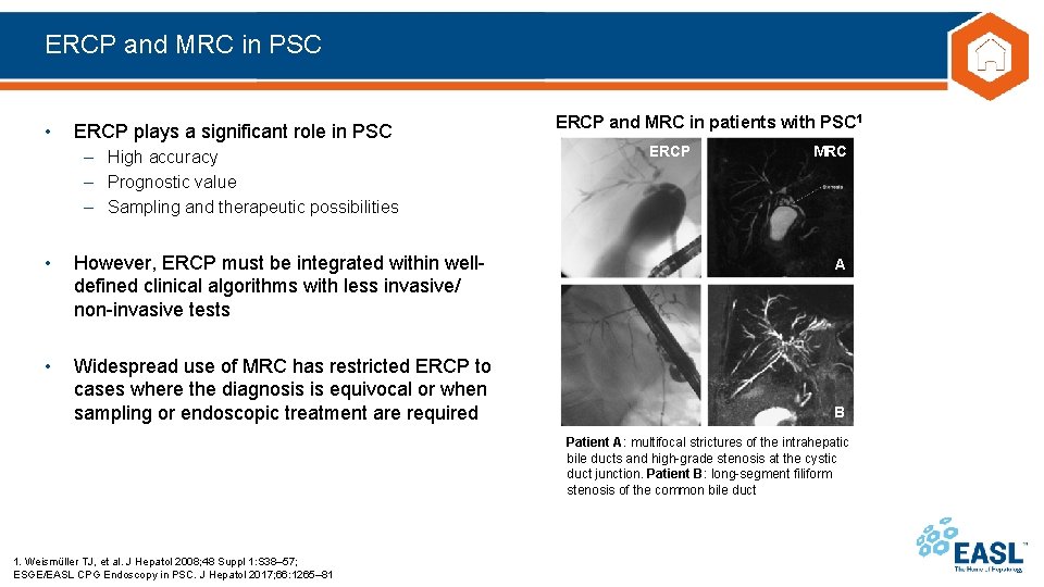 ERCP and MRC in PSC • ERCP plays a significant role in PSC –