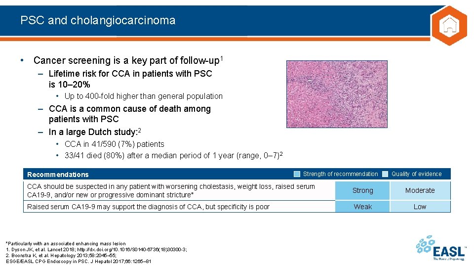 PSC and cholangiocarcinoma • Cancer screening is a key part of follow-up 1 –