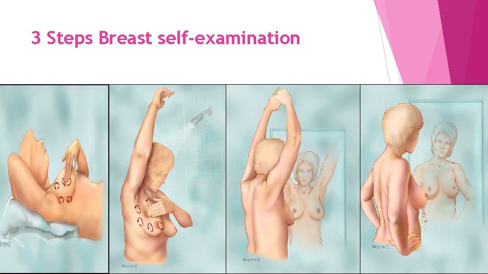 3 Steps Breast self-examination 