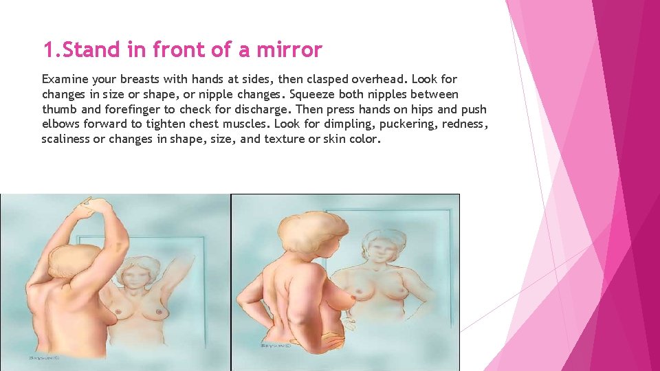 1. Stand in front of a mirror Examine your breasts with hands at sides,