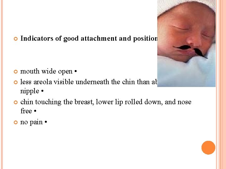  Indicators of good attachment and positioning: mouth wide open • less areola visible