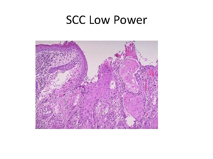 SCC Low Power 