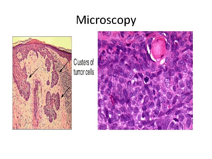 Microscopy 