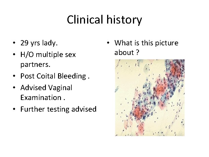 Clinical history • 29 yrs lady. • H/O multiple sex partners. • Post Coital