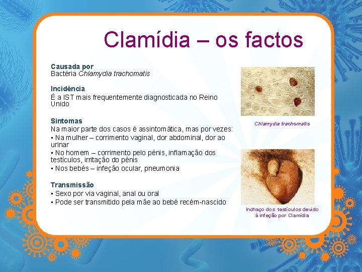 Clamídia – os factos Causada por Bactéria Chlamydia trachomatis Incidência É a IST mais