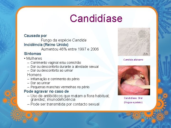 Candidíase Causada por Fungo da espécie Candida Incidência (Reino Unido) Aumentou 46% entre 1997