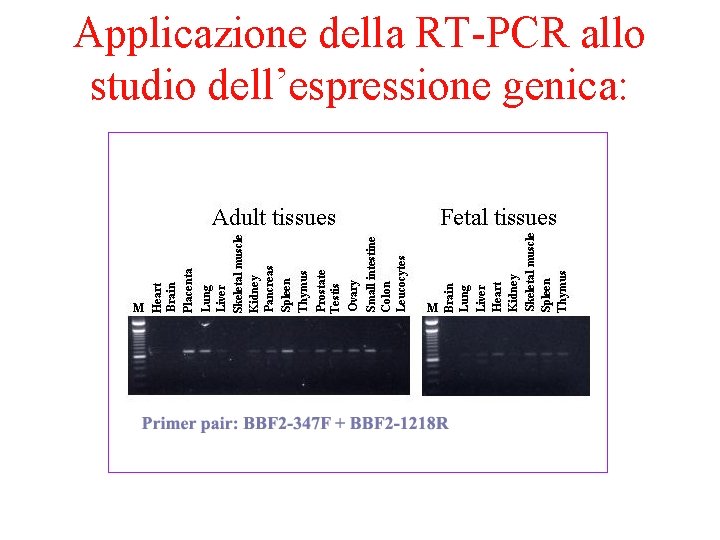 Applicazione della RT-PCR allo studio dell’espressione genica: 