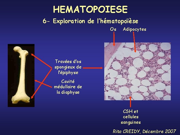 HEMATOPOIESE 6 - Exploration de l’hématopoïèse Os Adipocytes Travées d’os spongieux de l’épiphyse Cavité