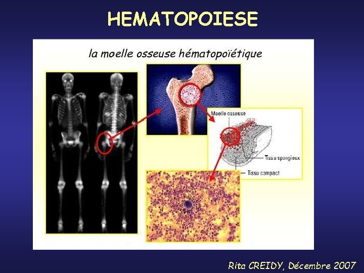 HEMATOPOIESE Rita CREIDY, Décembre 2007 