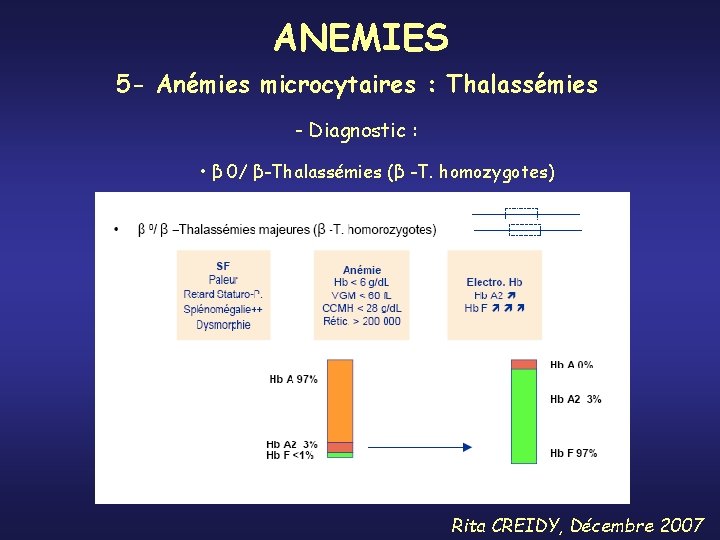 ANEMIES 5 - Anémies microcytaires : Thalassémies - Diagnostic : • β 0/ β-Thalassémies