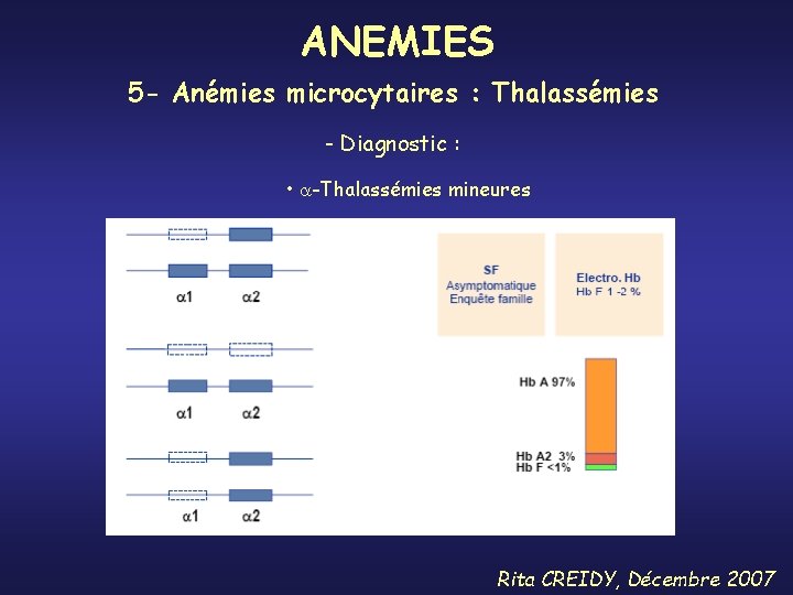 ANEMIES 5 - Anémies microcytaires : Thalassémies - Diagnostic : • -Thalassémies mineures Rita