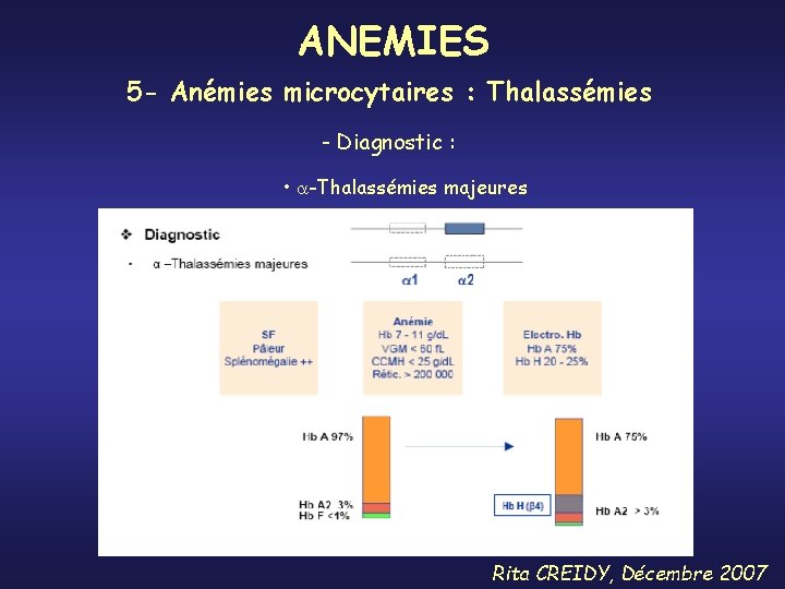 ANEMIES 5 - Anémies microcytaires : Thalassémies - Diagnostic : • -Thalassémies majeures Rita