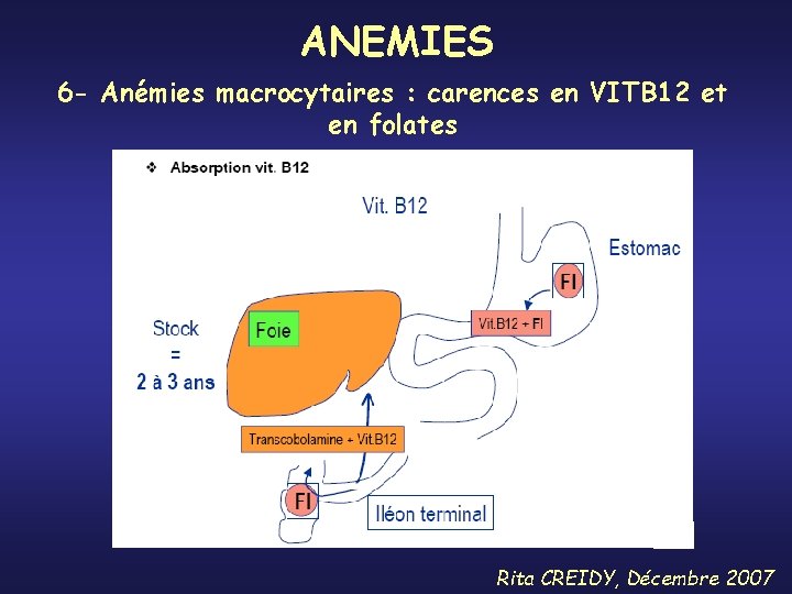 ANEMIES 6 - Anémies macrocytaires : carences en VITB 12 et en folates Rita